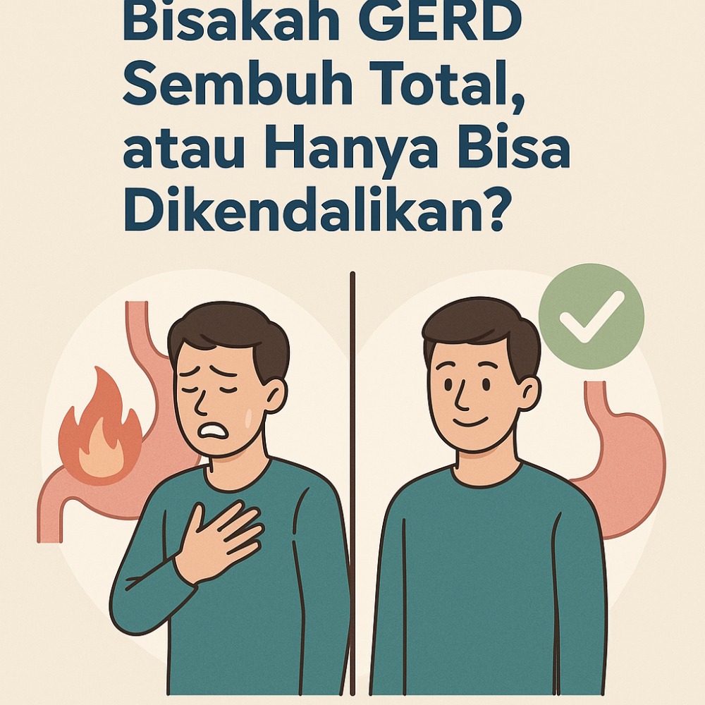 Bisakah GERD Sembuh Total, atau Hanya Bisa Dikendalikan? Bisakah GERD Sembuh Total, atau Hanya Bisa Dikendalikan?