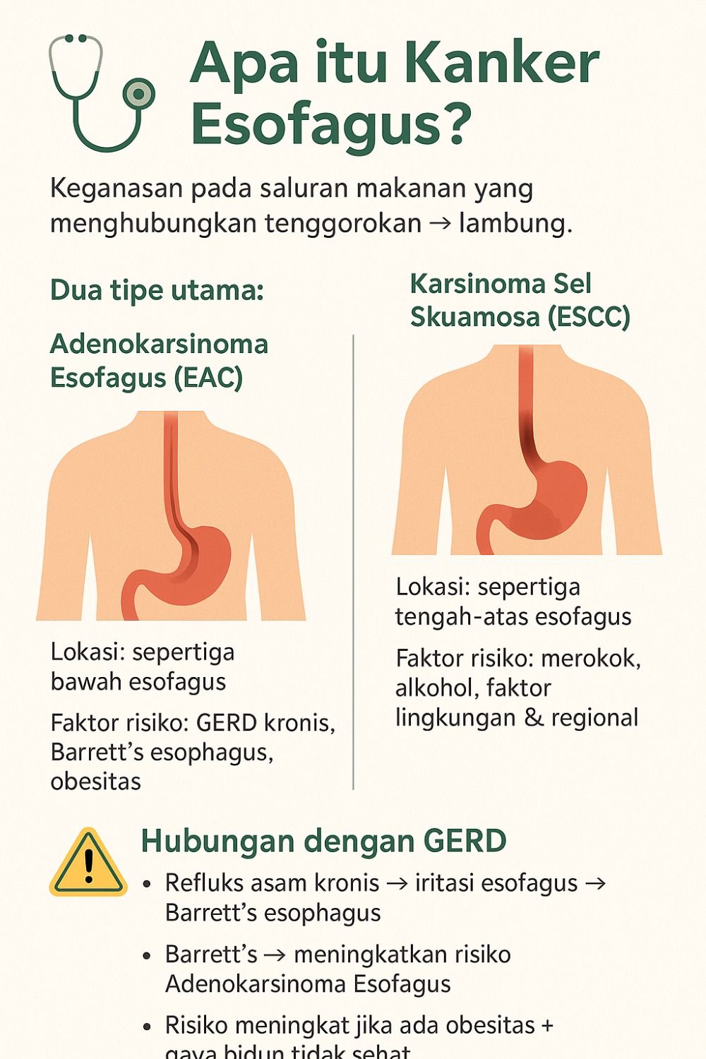 Kanker Esofagus: hubungan dengan GERD, cara pencegahan, & yang perlu Anda waspadai Kanker Esofagus: hubungan dengan GERD, cara pencegahan, & yang perlu Anda waspadai