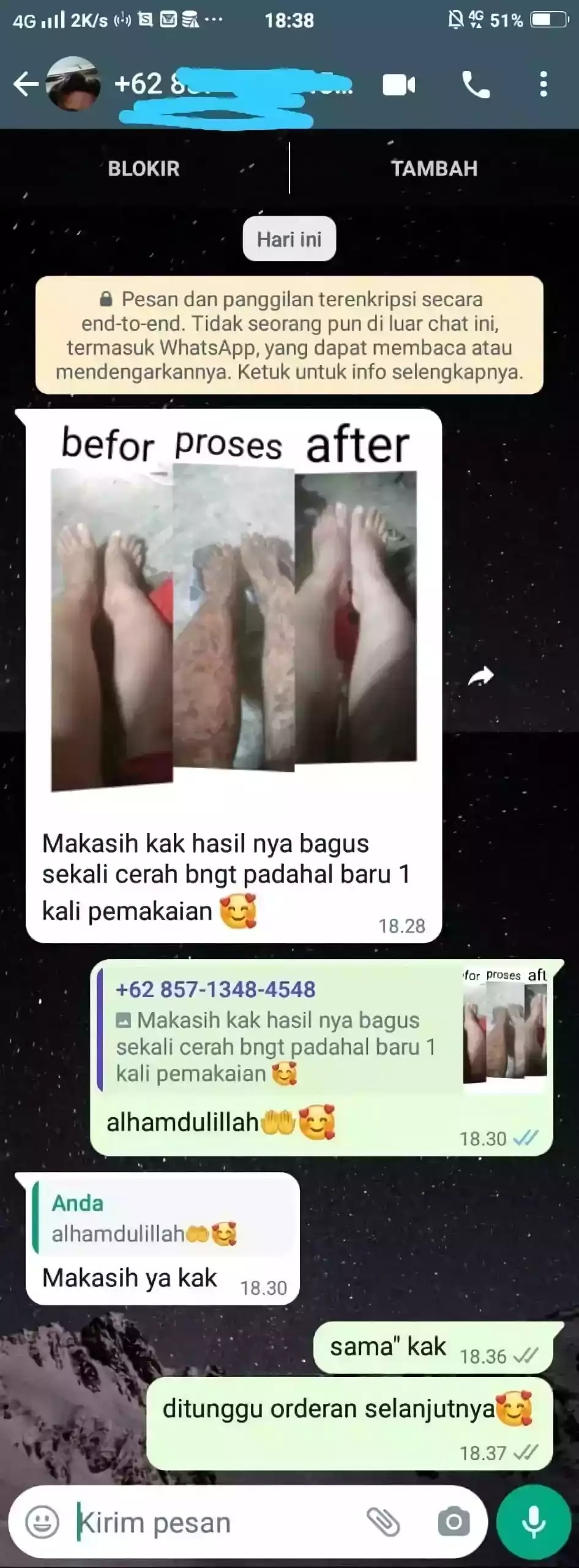 -