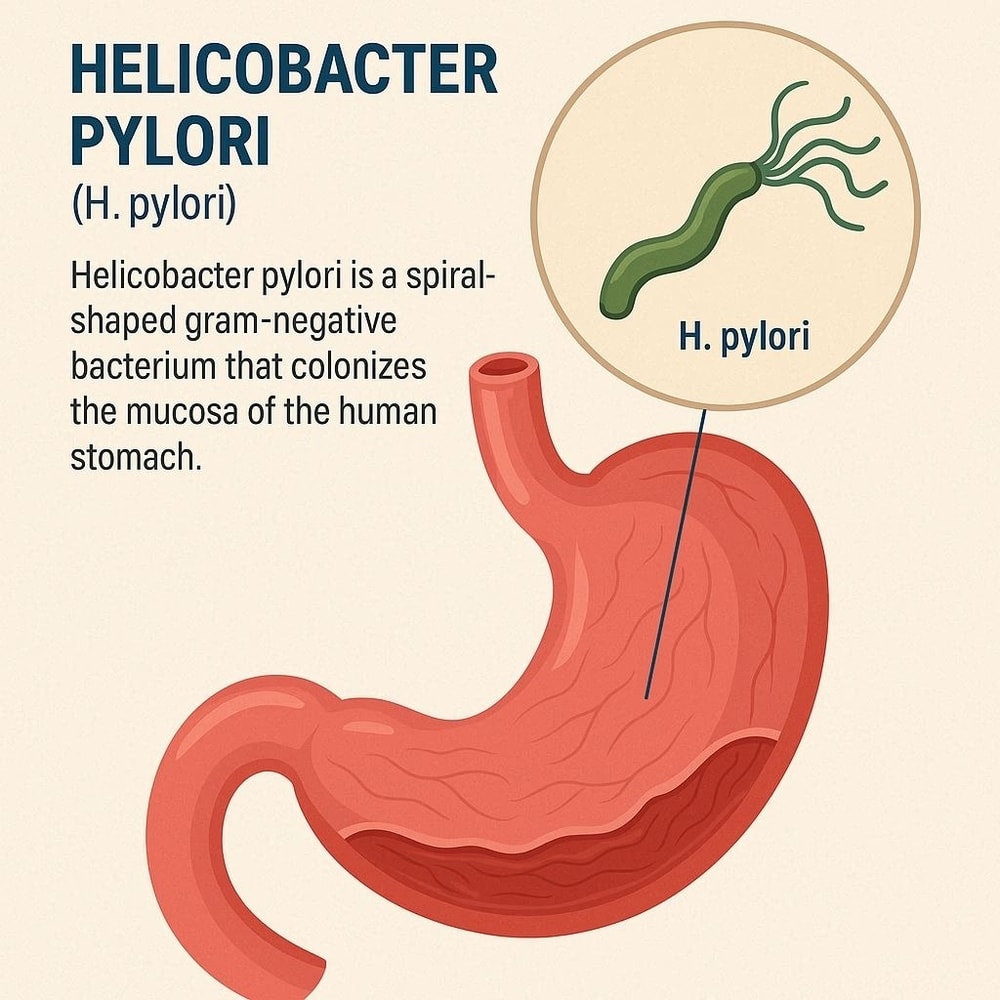 Helicobacter pylori: Definisi, Patogenesis, Diagnosis, dan Penatalaksanaan