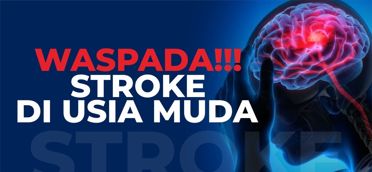 Ciri dan Penyebab Stroke di Usia Muda