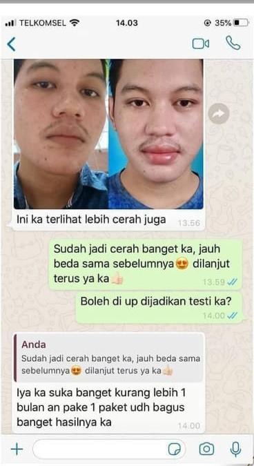 -