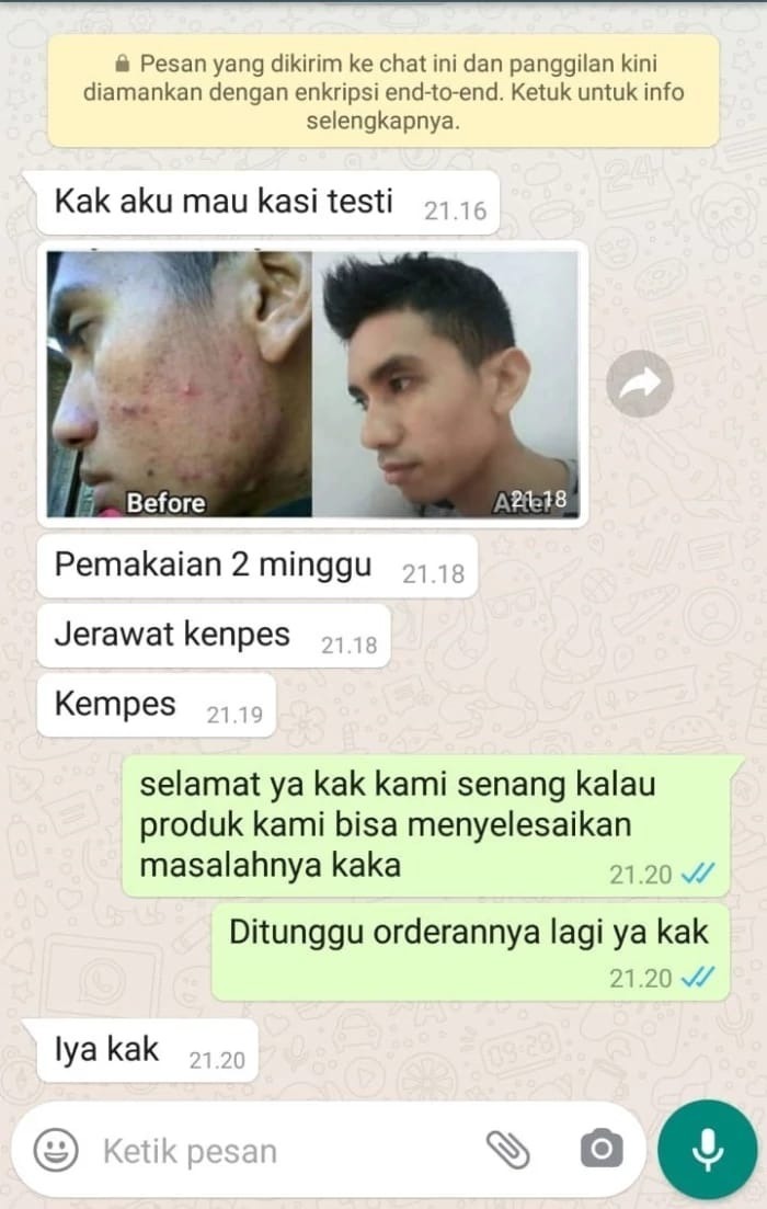 -