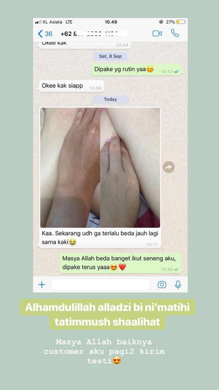 -