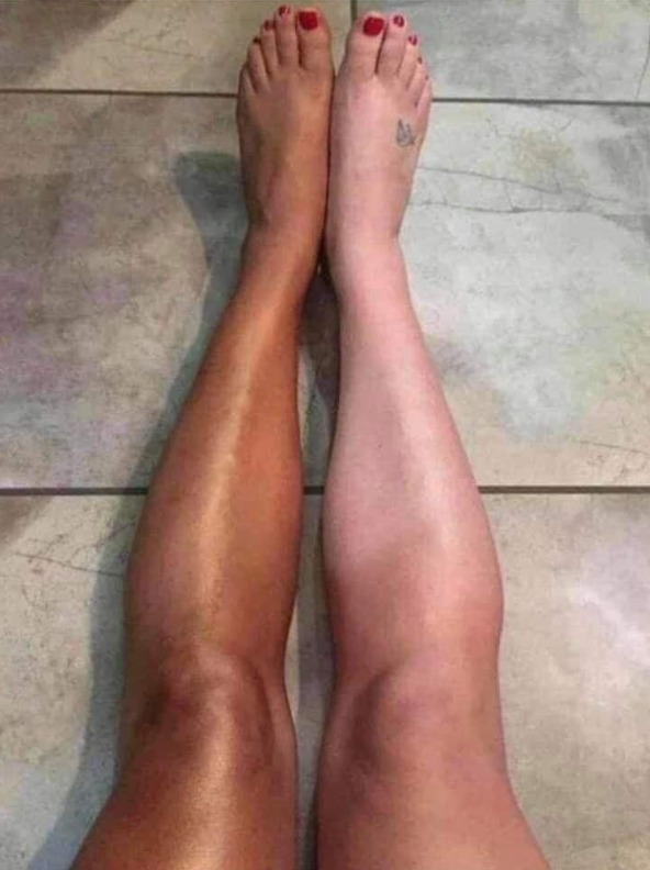 -