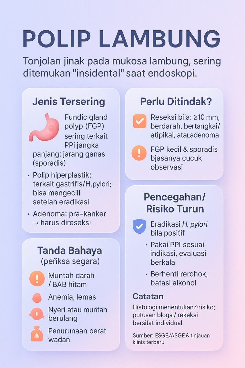 Polip pada Lambung: jenis, risiko kanker, pencegahan, penanganan, FAQ, dan kesimpulan