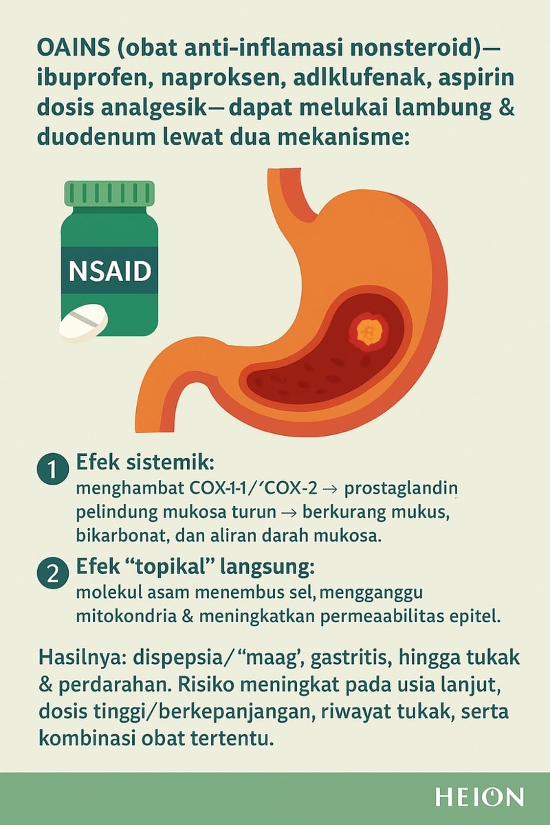 Kenapa OAINS dan Kortikosteroid Bisa Menyebabkan “Maag”?